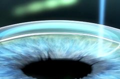 塘厦医院近视眼矫正怎么样？热门项目|科室医生信息公布啦