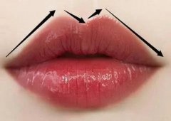 广州广大做唇腭裂怎么样？实力、口碑、项目全解析