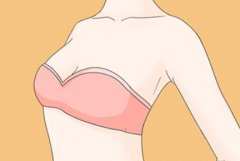 深圳美加美隆胸价格是多少？全新报价+到院流程+高性价比方案全攻略