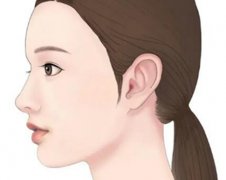 广州广大做正颌手术效果图怎么样？骨性凸嘴地包天术前术后对比一览速看