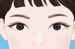 深圳美加美整形医院割双眼皮怎么样？想避免踩坑，这几个关键信息你一定要先看