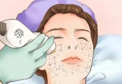 深圳阳光整形医院光子嫩肤多少钱？真实价目表+项目科普+注意事项都在这了