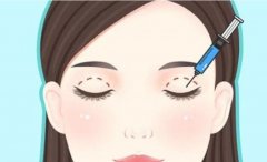 深圳鹏程做双眼皮怎么样？眼部项目反馈出炉，风格路线一文看
